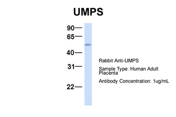 UMPS Rabbit Polyclonal Antibody