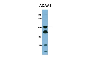 ACAA1 Rabbit Polyclonal Antibody