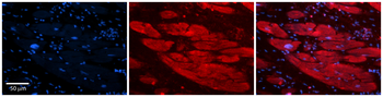 ENO3 Rabbit Polyclonal Antibody
