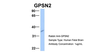 GPSN2 Rabbit Polyclonal Antibody