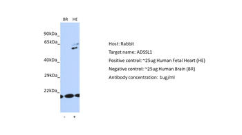 ADSSL1 Rabbit Polyclonal Antibody
