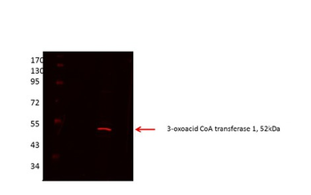OXCT1 Rabbit Polyclonal Antibody