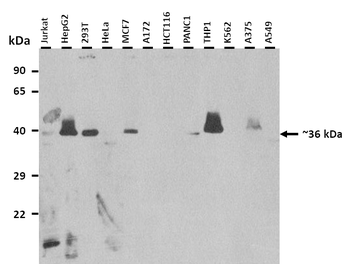NUDT17 Rabbit Polyclonal Antibody