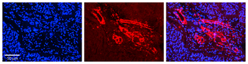 GGPS1 Rabbit Polyclonal Antibody