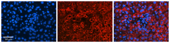 GLYAT Rabbit Polyclonal Antibody