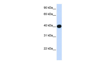 LIAS Rabbit Polyclonal Antibody