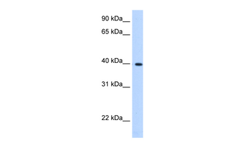 LIAS Rabbit Polyclonal Antibody