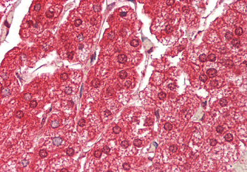 ATE1 Rabbit Polyclonal Antibody
