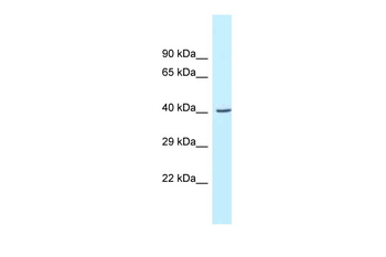 Gcat Rabbit Polyclonal Antibody