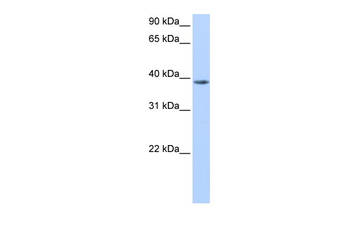 NUDT13 Rabbit Polyclonal Antibody