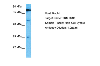 TRMT61B Rabbit Polyclonal Antibody