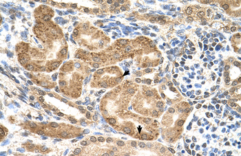 GMPPB Rabbit Polyclonal Antibody