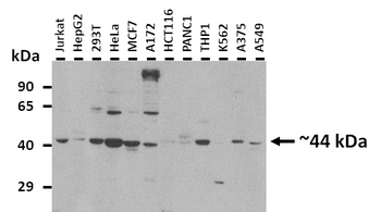 QTRT1 Rabbit Polyclonal Antibody