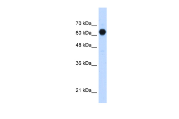 POMGNT2 Rabbit Polyclonal Antibody