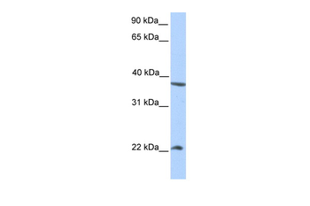 NEK7 Rabbit Polyclonal Antibody