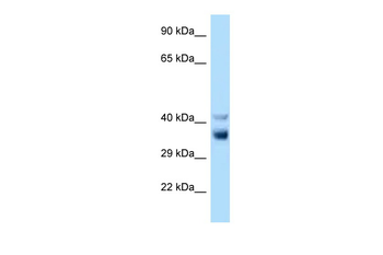 Nek7 Rabbit Polyclonal Antibody