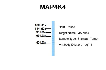 MAP4K4 Rabbit Polyclonal Antibody