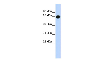 B3GALNT2 Rabbit Polyclonal Antibody