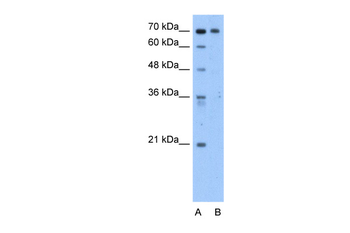 STKLD1 Rabbit Polyclonal Antibody