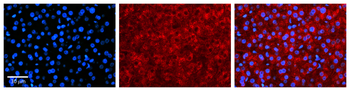SULT1A1 Rabbit Polyclonal Antibody