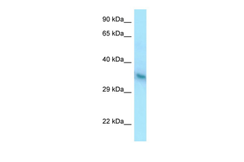 YIPF1 Rabbit Polyclonal Antibody