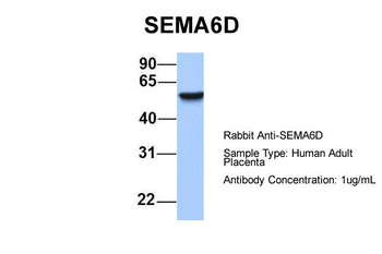 SEMA6D Rabbit Polyclonal Antibody