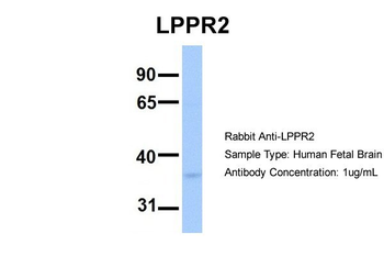 PLPPR2 Rabbit Polyclonal Antibody