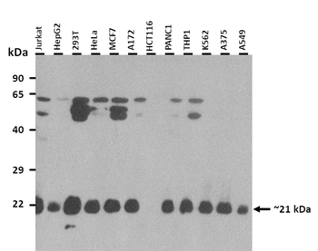 FNDC4 Rabbit Polyclonal Antibody