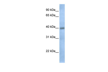 TXNDC15 Rabbit Polyclonal Antibody