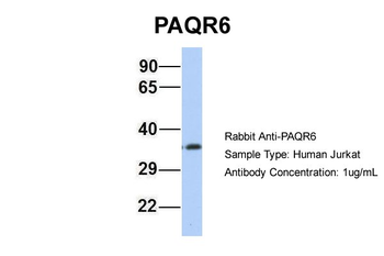 PAQR6 Rabbit Polyclonal Antibody