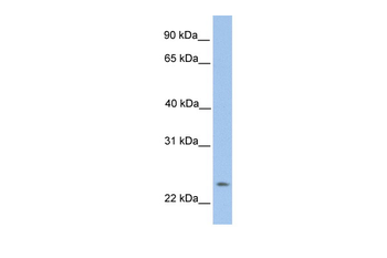 ORAI1 Rabbit Polyclonal Antibody
