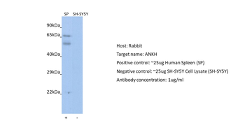 ANKH Rabbit Polyclonal Antibody