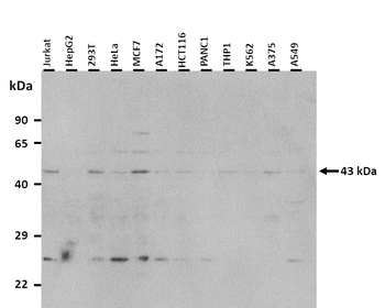 CYTB Rabbit Polyclonal Antibody