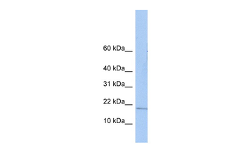 ZNHIT3 Rabbit Polyclonal Antibody