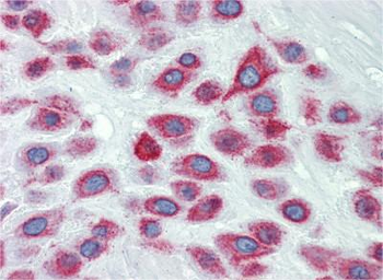 LIMD1 Rabbit Polyclonal Antibody