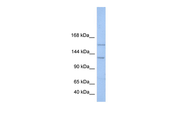 BRPF3 Rabbit Polyclonal Antibody