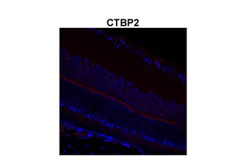 CTBP2 Rabbit Polyclonal Antibody