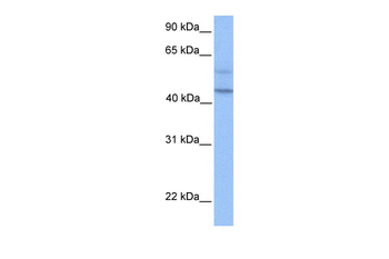 PDCD2L Rabbit Polyclonal Antibody