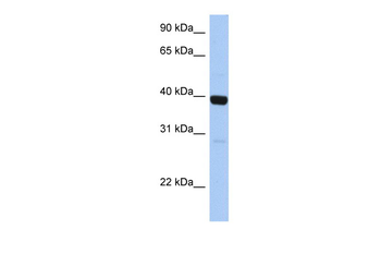 ZNF385B Rabbit Polyclonal Antibody