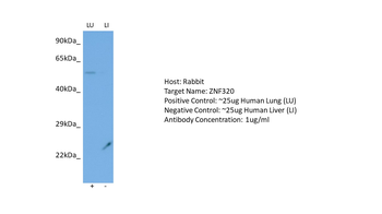 ZNF320 Rabbit Polyclonal Antibody