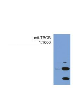 TBCB Rabbit Polyclonal Antibody