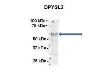 DPYSL2 Rabbit Polyclonal Antibody
