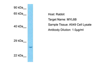 MYL6B Rabbit Polyclonal Antibody