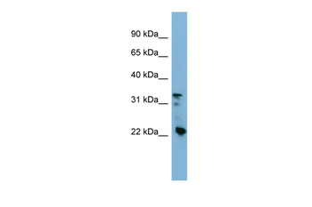 CRYBB3 Rabbit Polyclonal Antibody