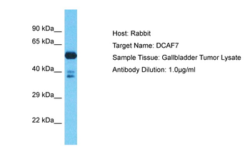 DCAF7 Rabbit Polyclonal Antibody