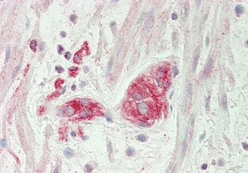 BCKDK Rabbit Polyclonal Antibody