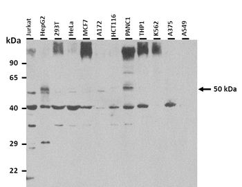 FGL2 Rabbit Polyclonal Antibody