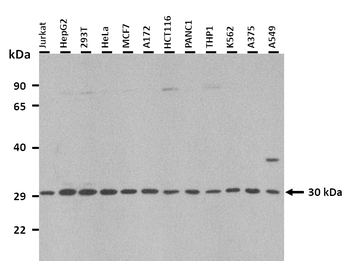 SPIN1 Rabbit Polyclonal Antibody