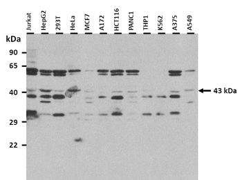 PRSS23 Rabbit Polyclonal Antibody