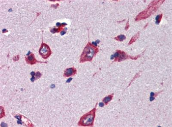 CBLN4 Rabbit Polyclonal Antibody
